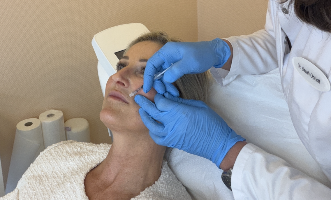 Ozempic Face Behandlung mit Filler