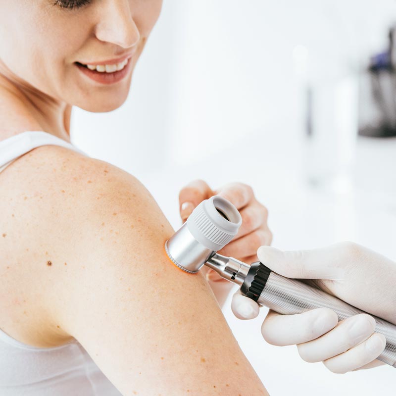 startseite-bilder-quadratisch1 Dr. Sarah Ophoff bei der ästhetischen Gesichtsbehandlung in ihrer Praxis am Tegernsee – professionell, einfühlsam und präzise. Sie trägt einen weißen Kittel mit Namensschild. Ihre Haare sind in einem Pferdeschwanze gebunden. Hautkrebsvorsorge